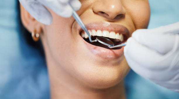 Best After-Hours Dental Trauma Care in South Vacherie, LA